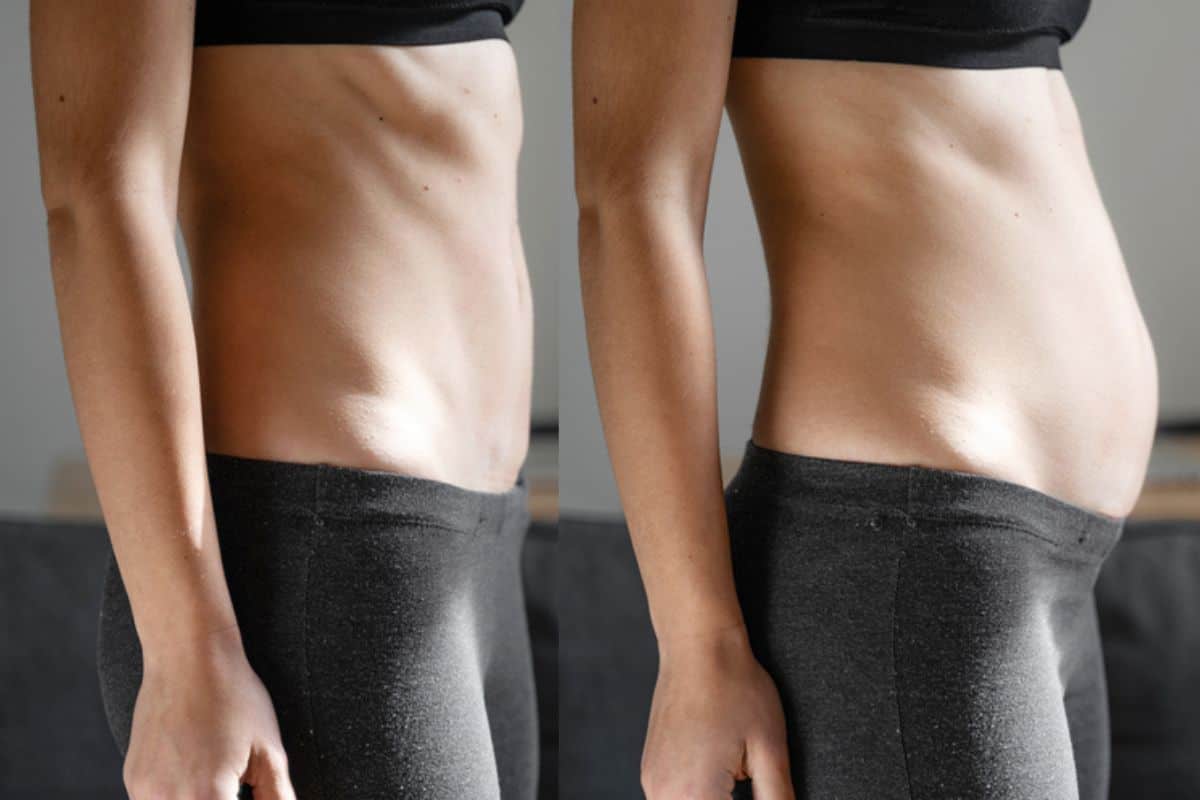 How long does diastasis recti take to improve Brompton?