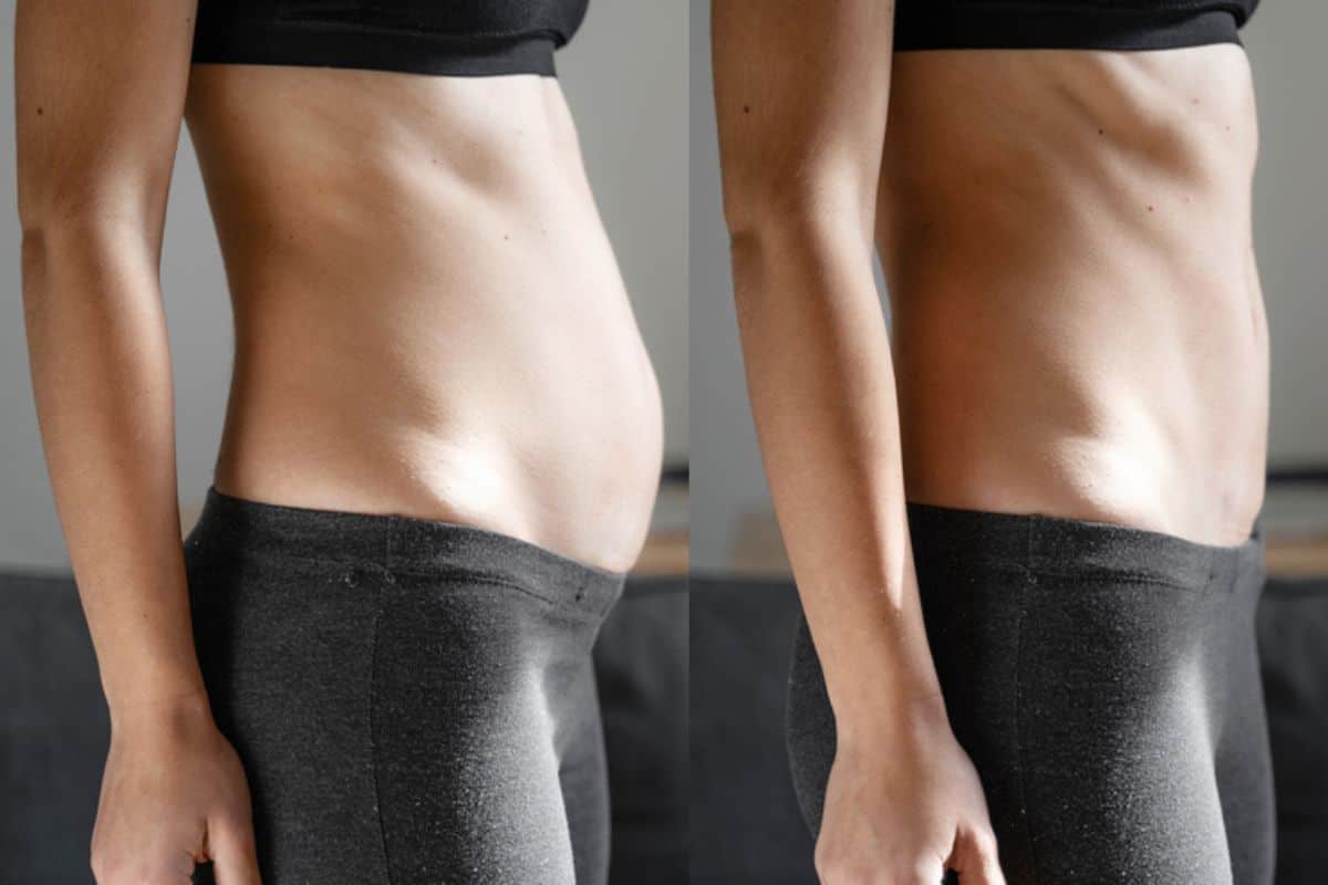 Post-Pregnancy: What Happens to Your Abdominal Muscles After Birth Brompton
