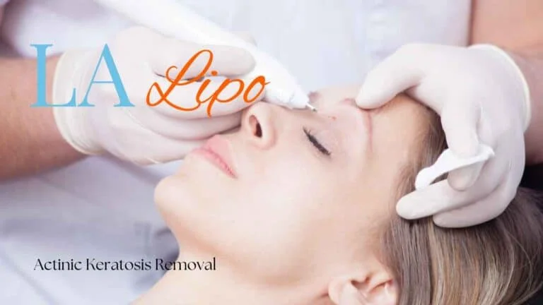 Woman receiving Actinic Keratosis Removal Treatment Brompton