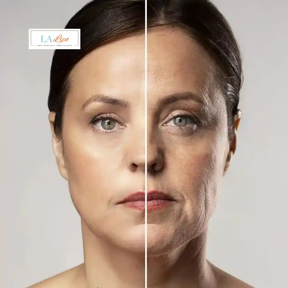 How Can You Tell If Non-Surgical Skin Tightening Is Right for You Brompton?
