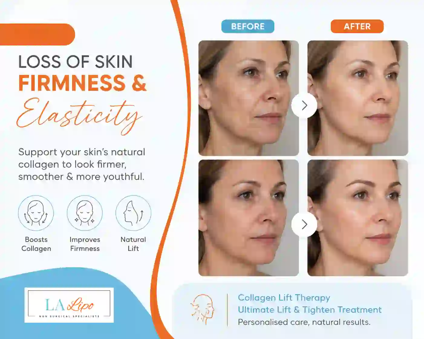 Sign #7: Loss of Skin Firmness and Elasticity Brompton