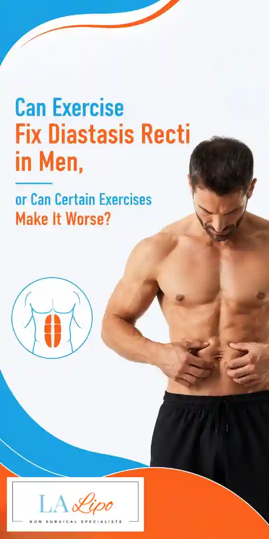 Can Exercise Fix Diastasis Recti in Men, or Can Certain Exercises Make It Worse Brompton?